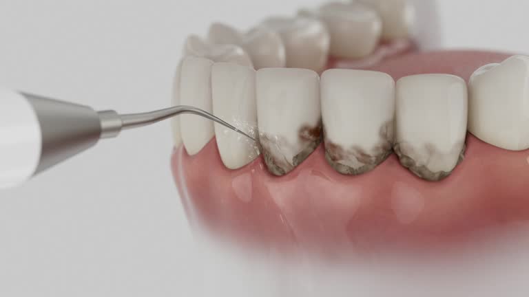 Reliable Emergency Dentist contractor in Sam Rayburn, TX by Smile Center Dentistry